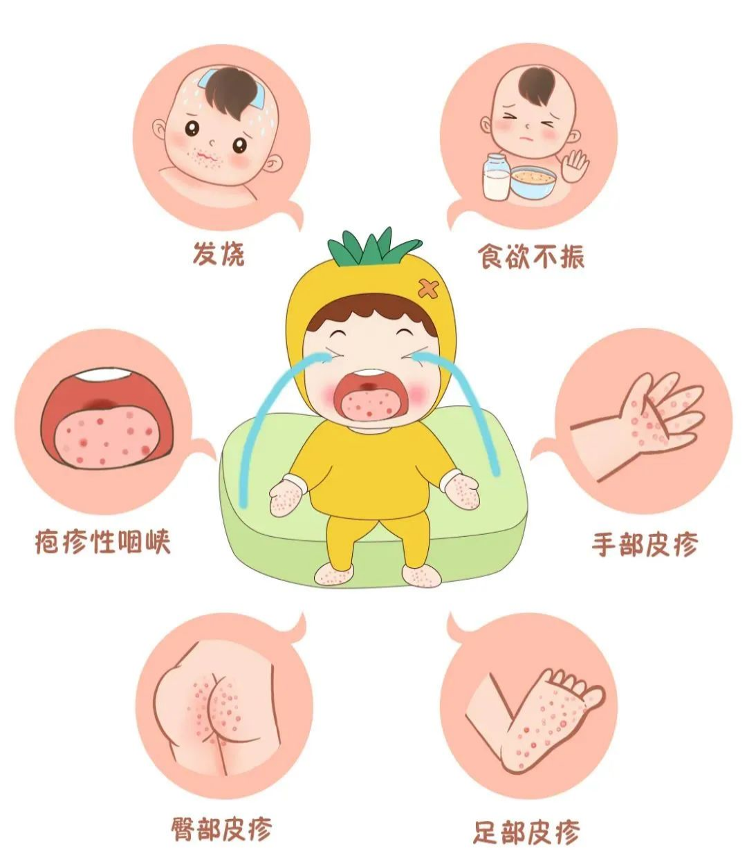婴儿辅食过敏小疹子图;婴儿辅食过敏长小疹 警惕小心辨识处理